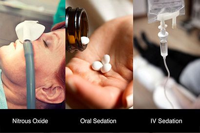 Various sedation options