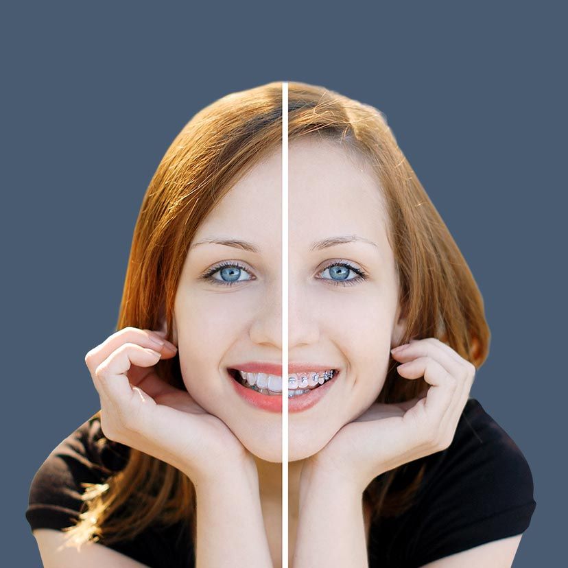 smiling girl with braces and Invisalign